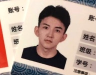"예능 방송서 머리숱 멀쩡한 제 사진을 도용해