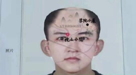 "예능 방송서 머리숱 멀쩡한 제 사진을 도용해