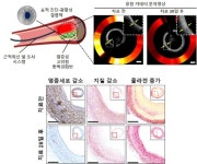고대 구로 김진원 교수, 빛으로 동맥경화 치료술 개발