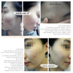 아띠아스킨케어 | 아띠스킨앤바디