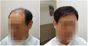 백작맞춤가발 | 이미지 맞춤가발
