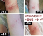 더고운에이치앤비 | 더건강에이치앤비
