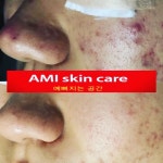 Ami Lee 스킨케어 | 아미스킨케어
