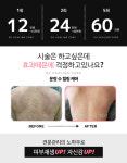 수앵들라뽀 에스테틱 | 수에스테틱 운정점