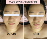 인셀덤맑음 | 서윤피부맑음 수내점