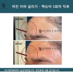 엘비스킨앤바디