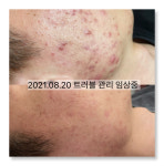 뿅단미피부전문센터 | 더고은피부전문센터 다산본점