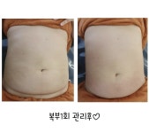 수앵들라뽀 에스테틱 | 수에스테틱 운정점
