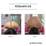 바른자세관리한바운 | 정한영바른자세관리센터