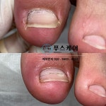 푸스양주 | 푸스케어 원주점