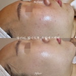 에스테틱the유빛 - 남구 용호로106번길 43-1 | 유빛에스테틱