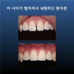 제이와이 치과쌤(JY 치과쌤) | 비와이씨디지털치과의원