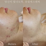 에스테틱the유빛 - 남구 용호로106번길 43-1 | 유빛에스테틱