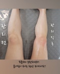 제이테라피
