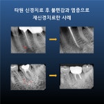 제이와이 치과쌤(JY 치과쌤) | 비와이씨디지털치과의원