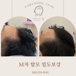 두피엔도트 | 도트365