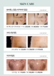 더블유스킨케어네일아트왁싱(W skincare nailart waxing) | 골든W 스킨앤왁싱