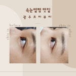 프리뷰티셀플라
