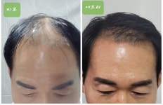 골드뷰티앤숲칼프 | 뷰티앤숲칼프