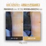 이사빛바디케어 | 새빛스킨&바디