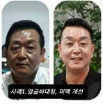 에이스is인셀덤 | 스텔라인셀덤