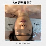 브릴리언트캠핑이천지사 | 브릴랑스킨 이천점