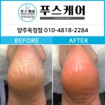 푸스양주 | 푸스케어 양주옥정점