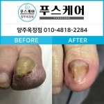 푸스양주 | 푸스케어 양주옥정점