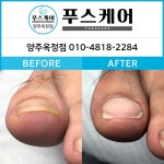 푸스양주 | 푸스케어 양주옥정점