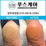 푸스양주 | 푸스케어 양주옥정점