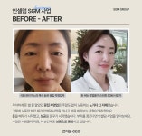 인셀덤 스파클링 8호 | 인셀덤 스파클링