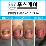 푸스양주 | 푸스케어 양주옥정점