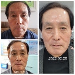 인셀덤비앤비최우수대리점 | 인셀덤 비앤비 킹덤대리점