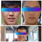 인셀덤비앤비최우수대리점 | 인셀덤 비앤비 킹덤대리점