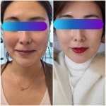 인셀덤비앤비최우수대리점 | 인셀덤 비앤비 킹덤대리점