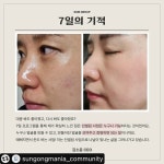 인셀덤비앤비최우수대리점 | 인셀덤 비앤비 킹덤대리점