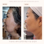 키썸에스테틱 병점본점