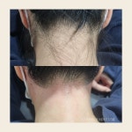 예스다 뷰티앤왁싱 본점 | 뷰티아 슈가링왁싱 아인병원점