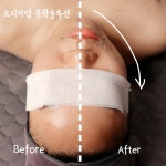 인셀덤 부산명륜점 | 클라르떼 부산동래명륜점