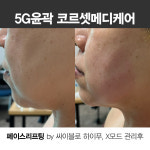 스파 리파인(Spa Refine) | 스파리파인 spa리파인