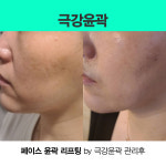 스파 리파인(Spa Refine) | 스파리파인 spa리파인
