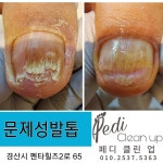 #손톱에 물들다 화원 | 샵 손톱에 물들다&페디클린업 내성발톱.무좀발톱.발각질