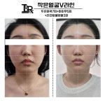 송윤희스킨엔바디 | 투모로우 스킨엔바디