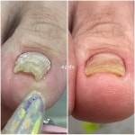풀리메디시흥월곶점네일박스 | 동성제약 풀리메디 시흥월곶점 네일박스