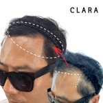 클라라뷰티