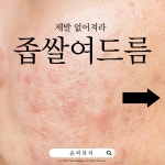 강자야피부샵 | 피부야