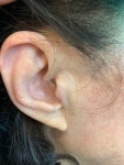 이화메디케어보청기 | 이화보청기청각언어센터