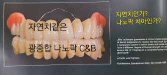 (주)찬스앤비티오듀오 | 찬스덴탈
