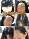 칠월림 헤드스파