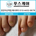 푸스양주 | 해사하다 푸스케어 천안아산역점